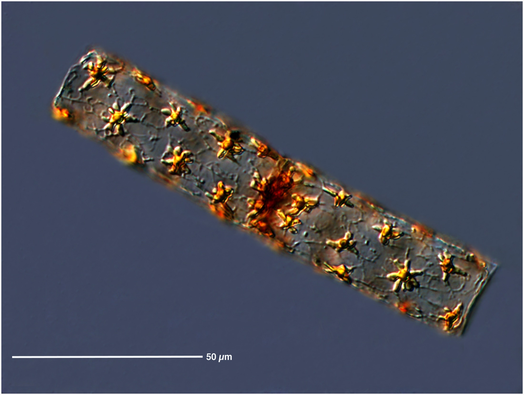 Star-shaped colonial diatoms radiating outward like a firework under the microscope.